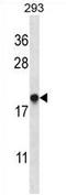 ER Membrane Protein Complex Subunit 4 antibody, AP54293PU-N, Origene, Western Blot image 