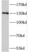 Signal-Induced Proliferation-Associated 1 antibody, FNab07872, FineTest, Western Blot image 