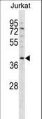 DNA Methyltransferase 3 Like antibody, LS-C167497, Lifespan Biosciences, Western Blot image 