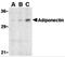 Adiponectin, C1Q And Collagen Domain Containing antibody, 3553, ProSci, Western Blot image 