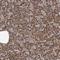 Tetratricopeptide Repeat Domain 27 antibody, NBP1-82195, Novus Biologicals, Immunohistochemistry paraffin image 