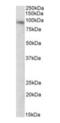 Deltex E3 Ubiquitin Ligase 3 antibody, orb20428, Biorbyt, Western Blot image 