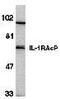 Interleukin 1 Receptor Accessory Protein antibody, GTX28109, GeneTex, Western Blot image 