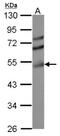 Tyrosyl-DNA phosphodiesterase 2 antibody, NBP2-16386, Novus Biologicals, Western Blot image 
