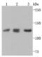 ABL Proto-Oncogene 2, Non-Receptor Tyrosine Kinase antibody, NBP2-67106, Novus Biologicals, Western Blot image 
