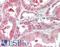 Kinesin Family Member 6 antibody, LS-B10297, Lifespan Biosciences, Immunohistochemistry paraffin image 