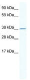 Ring Finger Protein 130 antibody, TA331857, Origene, Western Blot image 