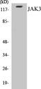 Janus Kinase 3 antibody, EKC1316, Boster Biological Technology, Western Blot image 