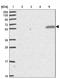 Tripartite Motif Containing 14 antibody, NBP2-47596, Novus Biologicals, Western Blot image 