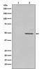 Cyclin E1 antibody, P00543, Boster Biological Technology, Western Blot image 