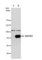 Mitogen-Activated Protein Kinase Kinase Kinase 3 antibody, NBP2-17273, Novus Biologicals, Western Blot image 