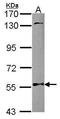 N-Myristoyltransferase 2 antibody, PA5-30568, Invitrogen Antibodies, Western Blot image 