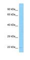 MYST/Esa1 Associated Factor 6 antibody, orb324472, Biorbyt, Western Blot image 