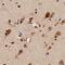Toll Like Receptor 7 antibody, GTX13732, GeneTex, Immunohistochemistry paraffin image 