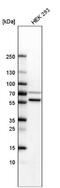 SET Domain Containing 6, Protein Lysine Methyltransferase antibody, NBP1-93955, Novus Biologicals, Western Blot image 