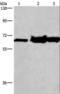 Choline Dehydrogenase antibody, LS-C404814, Lifespan Biosciences, Western Blot image 
