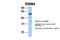 RNA Binding Motif Protein 4 antibody, 29-298, ProSci, Enzyme Linked Immunosorbent Assay image 