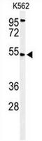 CALC antibody, AP50741PU-N, Origene, Western Blot image 