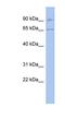 RAS Guanyl Releasing Protein 2 antibody, NBP1-58871, Novus Biologicals, Western Blot image 