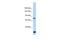 Fibronectin Type III Domain Containing 3A antibody, A10398, Boster Biological Technology, Western Blot image 