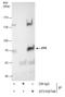 Spleen Associated Tyrosine Kinase antibody, GTX100748, GeneTex, Immunoprecipitation image 