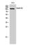 Glutamate Ionotropic Receptor Delta Type Subunit 2 antibody, GTX33977, GeneTex, Western Blot image 