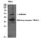 Olfactory Receptor Family 10 Subfamily H Member 3 antibody, A16868, Boster Biological Technology, Western Blot image 