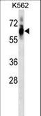 Cyclin Dependent Kinase 8 antibody, LS-C164337, Lifespan Biosciences, Western Blot image 