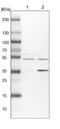 Actin Related Protein 6 antibody, NBP1-89000, Novus Biologicals, Western Blot image 