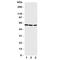 Cytochrome P450 Family 19 Subfamily A Member 1 antibody, R31219, NSJ Bioreagents, Western Blot image 