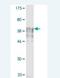 Interleukin 11 Receptor Subunit Alpha antibody, H00003590-M02, Novus Biologicals, Western Blot image 