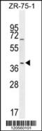 JunB Proto-Oncogene, AP-1 Transcription Factor Subunit antibody, 56-001, ProSci, Western Blot image 