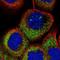 OTU Deubiquitinase 7A antibody, NBP1-88434, Novus Biologicals, Immunocytochemistry image 