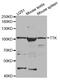 Dual specificity protein kinase TTK antibody, TA332526, Origene, Western Blot image 