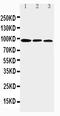 Aryl Hydrocarbon Receptor antibody, PA1782-2, Boster Biological Technology, Western Blot image 
