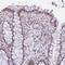 High Mobility Group Nucleosome Binding Domain 1 antibody, NBP2-47433, Novus Biologicals, Immunohistochemistry paraffin image 