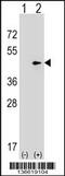 Septin 2 antibody, 58-704, ProSci, Western Blot image 