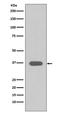 Musashi RNA Binding Protein 2 antibody, M02898, Boster Biological Technology, Western Blot image 