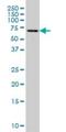 FGR Proto-Oncogene, Src Family Tyrosine Kinase antibody, H00002268-M01, Novus Biologicals, Western Blot image 