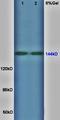 Fms Related Tyrosine Kinase 1 antibody, orb11556, Biorbyt, Western Blot image 