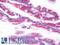 Sodium Channel Epithelial 1 Beta Subunit antibody, LS-B9624, Lifespan Biosciences, Immunohistochemistry frozen image 