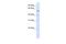 Tripartite Motif Containing 49 antibody, A16632, Boster Biological Technology, Western Blot image 