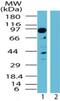 TGF-Beta Activated Kinase 1 (MAP3K7) Binding Protein 3 antibody, NBP2-24727, Novus Biologicals, Western Blot image 