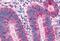 Melanin Concentrating Hormone Receptor 1 antibody, MBS243502, MyBioSource, Immunohistochemistry paraffin image 
