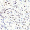 M31 antibody, A04206, Boster Biological Technology, Immunohistochemistry paraffin image 