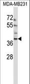 EMI Domain Containing 1 antibody, LS-C167748, Lifespan Biosciences, Western Blot image 