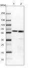 Chaperonin Containing TCP1 Subunit 6A antibody, NBP2-46715, Novus Biologicals, Immunohistochemistry frozen image 