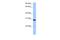 RALY RNA Binding Protein Like antibody, A12639, Boster Biological Technology, Western Blot image 