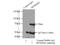 Ribosomal Protein S6 Kinase B1 antibody, 14485-1-AP, Proteintech Group, Immunoprecipitation image 