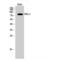 Cyclic Nucleotide Gated Channel Alpha 2 antibody, LS-C382782, Lifespan Biosciences, Western Blot image 